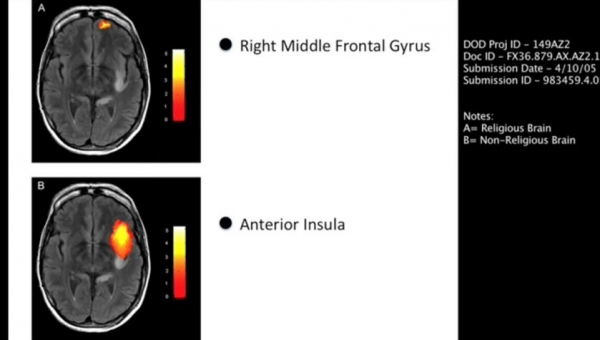 Eliminar el gen divino wmat2 es un atentado al ser humano